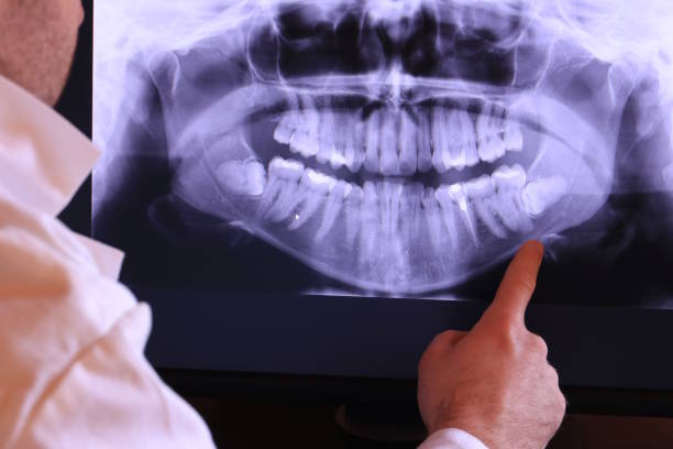 Best Mobile Emergency Dentist in Porter, IN
